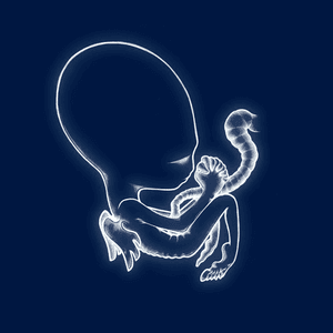 Sigur Rós
